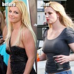 Did Britney Spears Have Plastic Surgery?