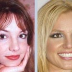 Britney Spears Plastic Surgery