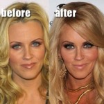 Jenny McCarthy Plastic Surgery Before After 150x150 Channing Tatum’s Favorite Music