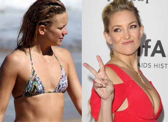 Kate Hudson Plastic Surgery Kate Hudson Plastic Surgery Breast Implant Before and After