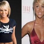Sara Underwood Plastic Surgery 150x150 Ashley Greene Nose Job Before and After