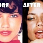 Adriana Lima Plastic Surgery Before and After