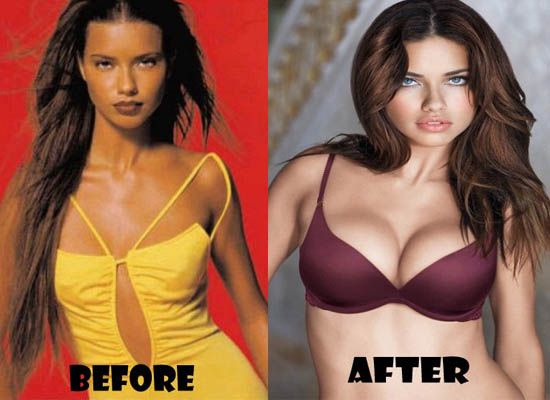 Adriana Lima Plastic Surgery Adriana Lima Plastic Surgery Before and After Pictures