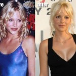 Anna Faris Plastic Surgery