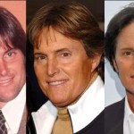 Bruce Jenner Plastic Surgery
