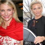 Cameron Diaz Plastic Surgery