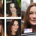 Carla Bruni Plastic Surgery Pictures