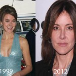 Christa Miller Plastic Surgery Before and After Picture