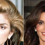 Cindy Crawford Plastic Surgery Before and After
