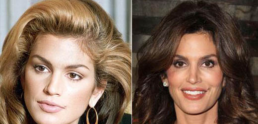 Cindy Crawford Plastic Surgery Cindy Crawford Plastic Surgery Before and After