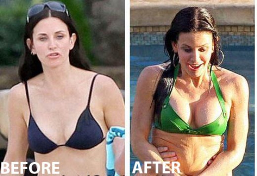 Courteney Cox Plastic Surgery Before After