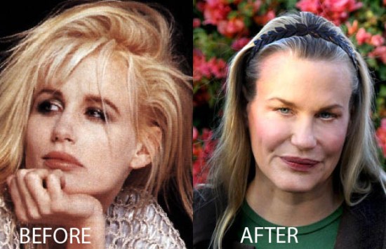 Daryl Hannah Plastic Surgery Daryl Hannah Plastic Surgery Before and After