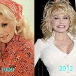 Dolly Parton Plastic Surgery Before and After Pictures