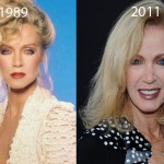 Did Donna Mills Have Plastic Surgery?