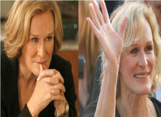 Glenn Close Plastic Surgery Before and After Did Glenn Close Have Plastic Surgery?