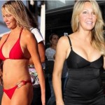 Heather Locklear Plastic Surgery Before and After Pictures