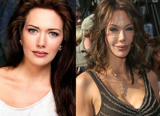 Hunter Tylo Plastic Surgery Hunter Tylo Plastic Surgery Before and After Pictures