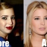 Ivanka Trump Plastic Surgery Before and After