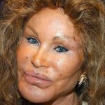 Jocelyn Wildenstein After Plastic Surgery