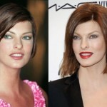 Linda Evangelista Plastic Surgery Botox Before and After