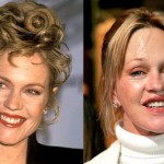 Melanie Griffith Plastic Surgery 150x150 Nicky Minaj : Compare Her with and without Makeup