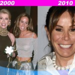 Melissa Rivers Plastic Surgery Before After