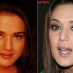 Preity Zinta Plastic Surgery Rumors – Before and After