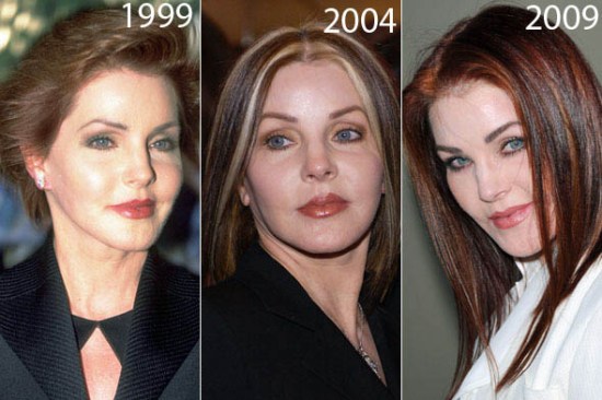 Priscilla Presley Plastic Surgery Before After Priscilla Presley Plastic Surgery Before and After