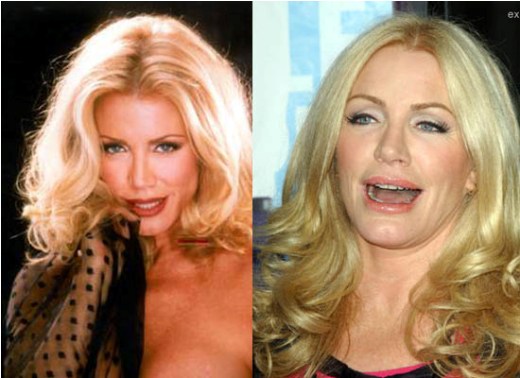 Shannon Tweed Plastic Surgery Shannon Tweed Plastic Surgery Before and After
