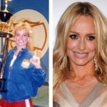 Taylor Armstrong Plastic Surgery