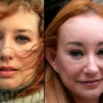 Tori Amos Before and After Plastic Surgery