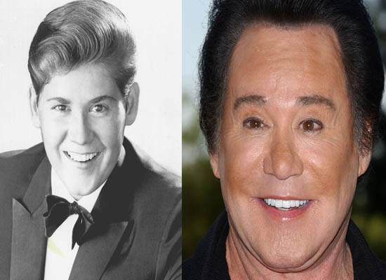 Wayne Newton Plastic Surgery Wayne Newton Plastic Surgery Before and After Picture