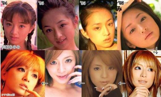 Ayumi Hamasaki Plastic Surgery Before After Ayumi Hamasaki Plastic Surgery Before and After Pictures