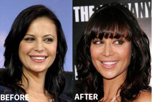 Catherine Bell plastic surgery Catherine Bell Plastic Surgery Before and After