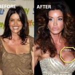 Janice Dickinson Plastic Surgery Before After