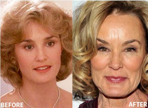 Jessica Lange Plastic Surgery Jessica Lange Plastic Surgery Before and After