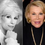 Joan Rivers Plastic Surgery Before and After