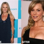Julie Benz Plastic Surgery Before and After