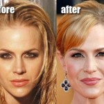 Julie Benz Plastic Surgery Before After