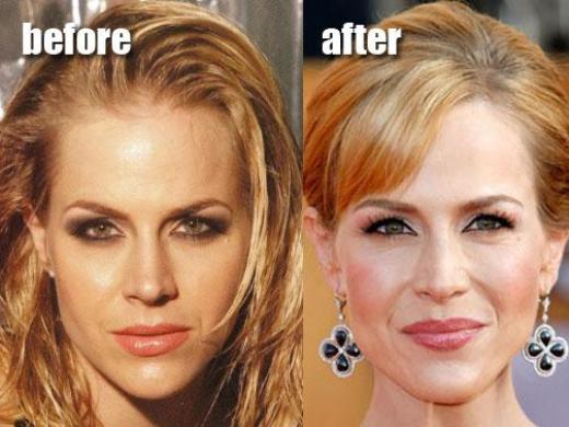 Julie Benz Plastic Surgery Before After
