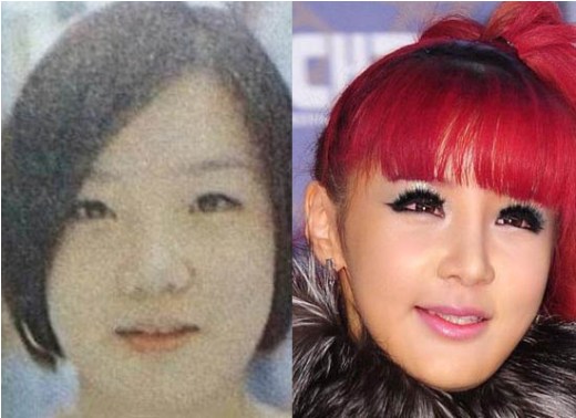Park Bom Plastic Surgery Park Bom Plastic Surgery Before and After
