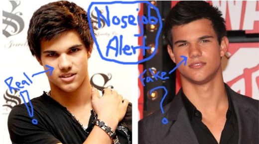 Taylor Lautner Nose Job Taylor Lautner Nose Job Before and After
