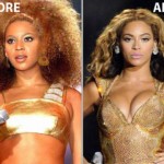 Beyonce Breast Implants Before and After