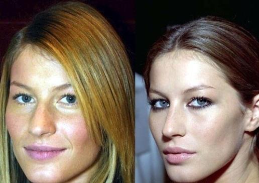 Gisele Bundchen Plastic Surgery Nose Job Gisele Bundchen Plastic Surgery Before and After