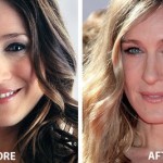 Sarah Jessica Parker Nose Job Before and After