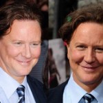 Judge Reinhold Plastic Surgery Before and After