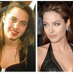 Did Angelina Jolie Have Plastic Surgery ?
