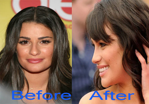 Lea Michele Nose Job Before and After Photo Did Lea Michele Get Plastic Surgery ?