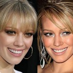 hillary duff nose job 150x150 Debating about the Young Look of Olivia Newton John Plastic Surgery