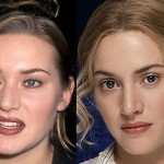 Kate Winslet Nose Job Before and After